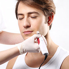 Microneedling